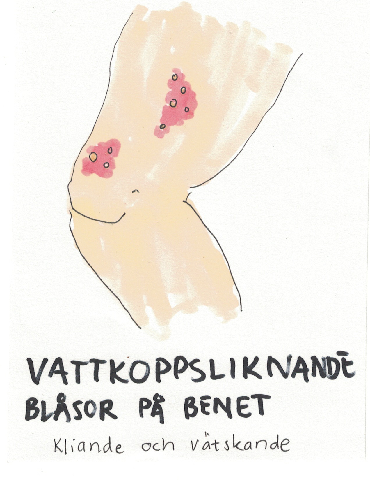 symptom35.jpg